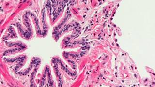 Introduction to Histopathology [upl. by Rollie]