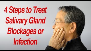 4 Steps to Treat Salivary Gland Swelling at Home [upl. by Richel]