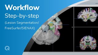 Workflow Lesion SegmentationFreeSurferSIENAX  Stepbystep presentation [upl. by Elyac]