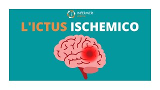 LICTUS ISCHEMICO  STROKE  INFERMIERI Online [upl. by Spanos630]