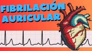 ¿Qué es la fibrilación auricular [upl. by Harv]