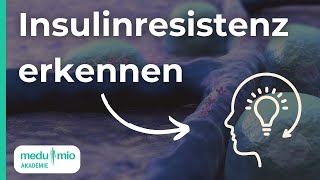 Insulinresistenz erklärt Ursachen Symptome amp mehr 📊 Dr Simone Koch [upl. by Kaufman]