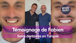 CLINIQUE DENTAIRE EN TURQUIE  🦷 Témoignage Fabien  20 couronnes Emax  gummy smile  BODYEXPERT [upl. by Houser]