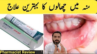 Mouth ulcer  Mouth sores Oral Fungal infection treatment  Daktarin oral gel How to use Review [upl. by Sadnak193]