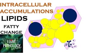 INTRACELLULAR ACCUMULATIONS LIPIDS Fatty Change [upl. by Gaw296]