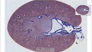 What your kidney looks like down the microscope [upl. by Nyloj905]