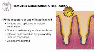 Acute GI Watery diarrhea and viruses [upl. by Nyladnor970]