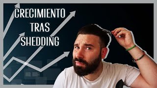 ¿CUÁNDO CRECE el CABELLO CAÍDO por SHEDDING [upl. by Akcirederf]