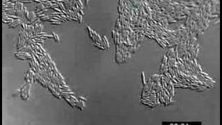 Pseudomonas aeruginosa twitching motility YFPPilU [upl. by Xena]