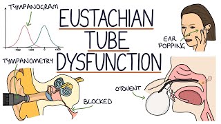 Understanding Eustachian Tube Dysfunction [upl. by Aztinad]