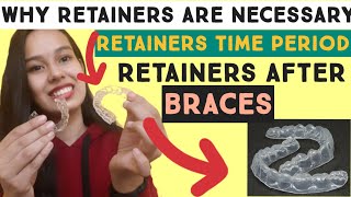 Proces after bracesretainers after braceswhat is retainerwhy retainers are important after braces [upl. by Ailana]