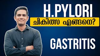 Hpylori ചികിത്സ എങ്ങനെ  Dr Sijil K S [upl. by Eissak]