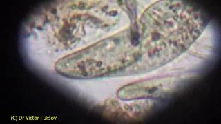 Life Under the Microscope Infusoria Paramecium Lives in Aquarium Kiev Ukraine [upl. by Wahkuna]