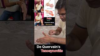 De Quervains tenosynovitis Rehab  De Quervains tenosynovitis Exercises [upl. by Burt]