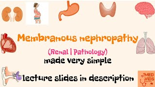 Membranous nephropathy  Renal  Pathology  Med Vids made simple [upl. by Mellitz]