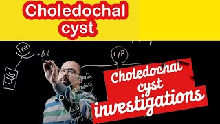 Ep 2  Choledochal Cyst Investigations  Dr Khaled Salah [upl. by Sidalg]