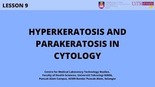 Hyperkeratosis and Parakeratosis in Cytology [upl. by Ardnod]