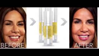 Instant Wrinkle Reducer 2017 Review Dont Buy Until You watch This [upl. by Khalsa562]