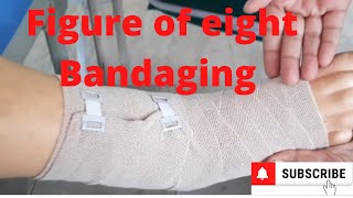 Figure of Eight Bandaging by PC nursing procedure [upl. by Timothea273]