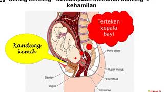 Mengapa Sering Kencing dimalam hari 4 [upl. by Assilanna]