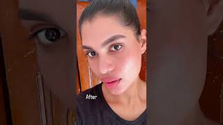 Full body peel jiore Transformation review Shop wwwjioreskinin [upl. by Anitac]