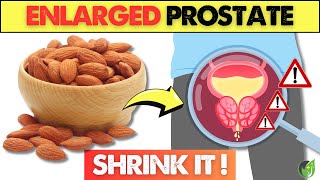 6 Nuts that THOUSANDS of People USING to SHRINK Their Enlarged Prostate  Health Journey [upl. by Nuri896]