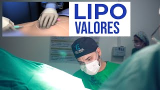 Quanto custa uma lipoaspiração  Valores e preços da lipo e da lipoescultura [upl. by Brittaney493]