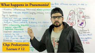 Pneumonia disease  Causes Symptoms Transmission prevention and treatment [upl. by Yeliac514]