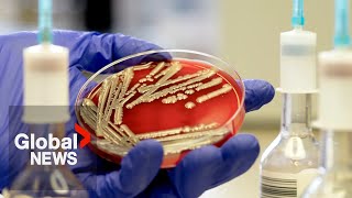 E coli outbreak How to protect yourself from bacteria infection [upl. by Fronia]