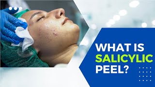 What is Salicylic Acid peel Does it actually work [upl. by Aiela990]