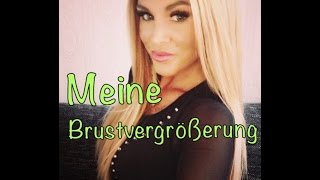 Meine Brustvergrösserung  Breast Implant German [upl. by Herzberg858]