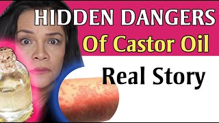 What You Need To Know About Castor Oil TRUE STORY Shared [upl. by Yenruoc301]