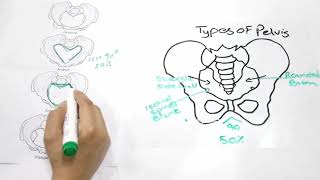 Types of Pelvis [upl. by Nitsirhc870]