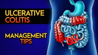 MANAGE ULCERATIVE COLITIS UC  SYMPTOMS amp TREATMENTS  ULCERATIVE COLITIS  IBD  UC MANAGEMENT [upl. by Urien]