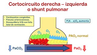 INSUFICIENCIA RESPIRATORIA  Parte 1 Concepto Clasificación y Fisiopatología 🤓👍🏻 [upl. by Lindsey778]