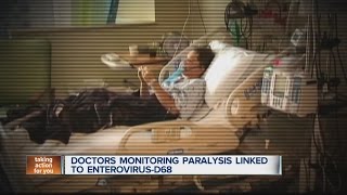 Doctors monitoring paralysis linked to Enterovirus D68 [upl. by Natanoj486]