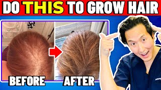 How to Treat Thinning Hair The Holistic Way [upl. by Kalbli]