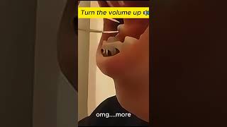 pimple popping 2024 new blackheads on nose pimple popping tiktok 2321212 [upl. by Coffee]