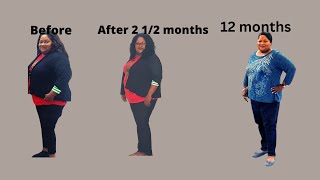 Ozempic weight loss before amp after 12 month update [upl. by Adarbil163]