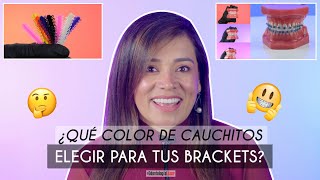 ¿Qué Color de Cauchos Elegir en mis Brackets ¿Cuál me beneficia 🎨  Odontología Láser [upl. by Lamprey]