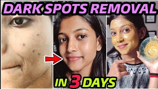 Dermatologist Recommended Best 3 Creams to remove Pimple Marks Acne Scars Dark Spots PIH [upl. by Henricks931]