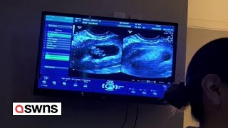 Moment couple found out they were expecting twins  for the second time  SWNS [upl. by Geiss]