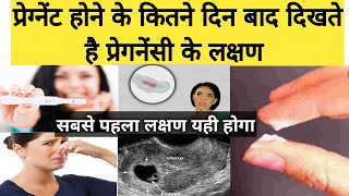 Pregnant🤰 hone ke kitne din baad dikhte hai Pregnancy Symptoms  Sabse pahla Lakshan Kya hoga [upl. by Klinger]