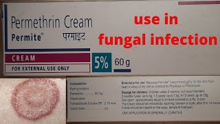 Permite cream use in hindi Permethrin use in allergy fungal infection [upl. by Celik]