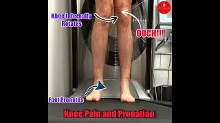 knee pain and overpronation [upl. by Rissa]