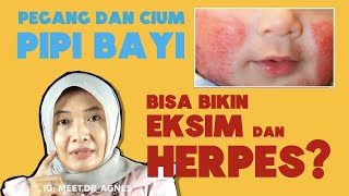 EKSIM DAN HERPES PADA BAYI [upl. by Utica]