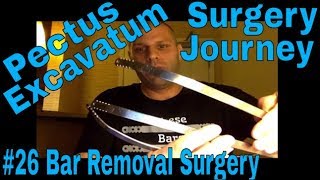 Pectus Excavatum Surgery Journey  Video 26  1082019  Bar Removal Surgery [upl. by Sallyanne]