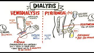 Failing Kidneys and Different Treatment Options [upl. by Fisch539]