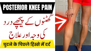 Posterior Knee Pain  Popliteus Muscle Pain  Back of Knee Pain  Tight Hamstrings  Physiotherapy [upl. by Kaya728]