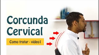 Adeus Corcunda  Como tratar a corcunda cervical Melhore a Postura – PARTE 1 [upl. by Asum]